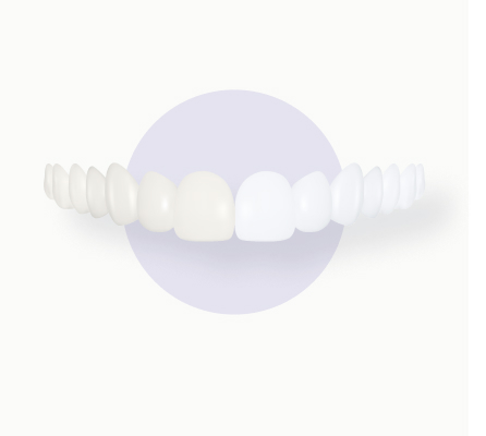 cosmetic dentistry in Mahnattan, KS - pearly white smiles