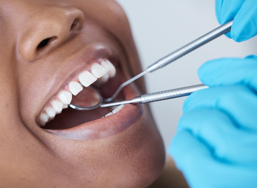 close up of a young woman's mouth during dental exam